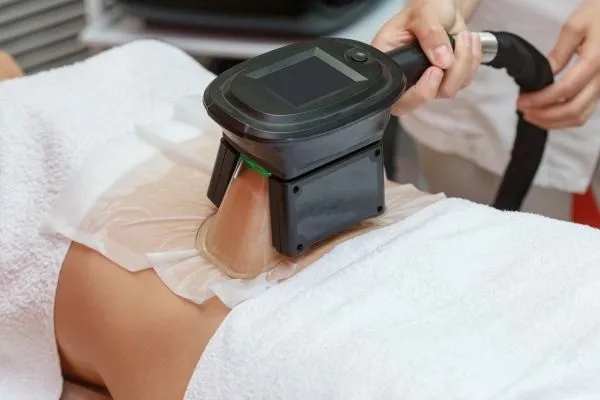 Image of person having fat freezing treatment to help weight gain Coleshill