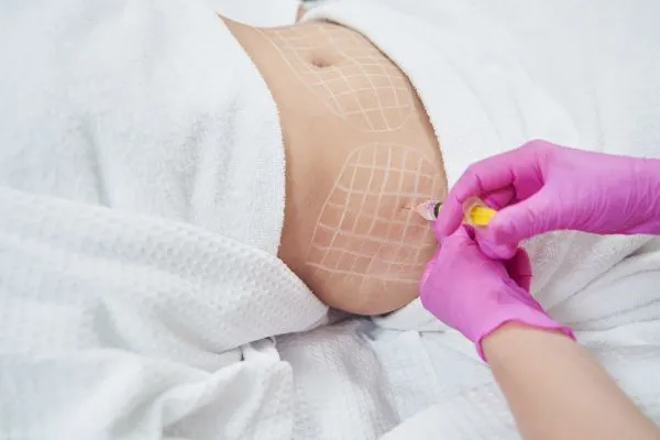 image of fat dissolving injections on love handles to help combat weight gain Coleshill