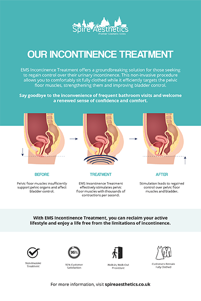 image of how urge incontinence Coleshill treatment works